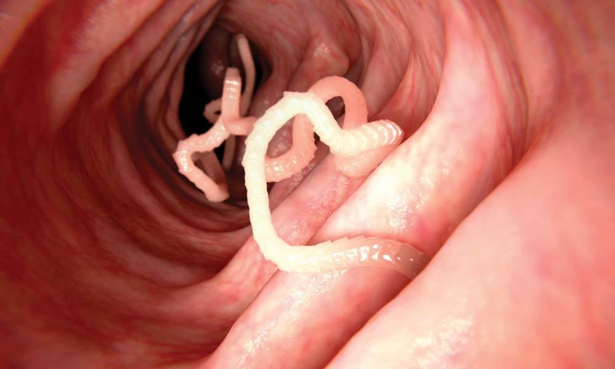 Featured image of post Human Pictures Of Tapeworms